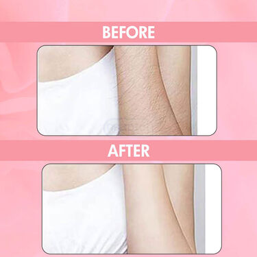 Painless Hair Remover Buy 1 Get 1
