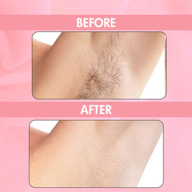 Painless Hair Remover Buy 1 Get 1