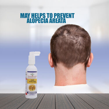 Hair Vitalizer For Alopecia Areata