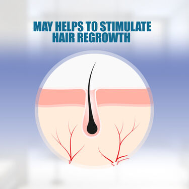 Hair Vitalizer For Alopecia Areata