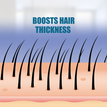 Hair Vitalizer For Alopecia Areata